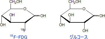18F-FDG(デオキシグルコール)